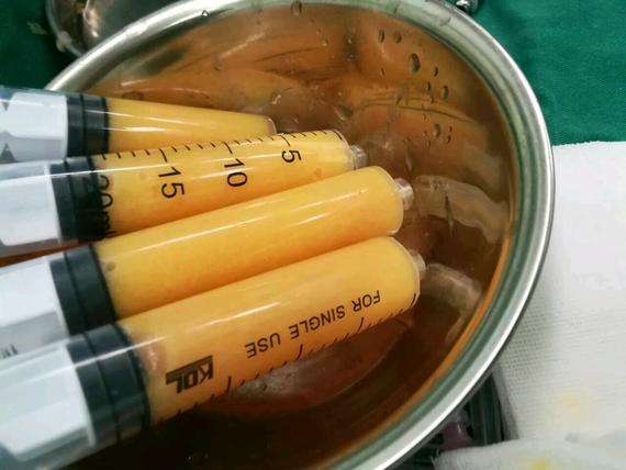 1545113687271080.jpg 1545113687271080.jpg